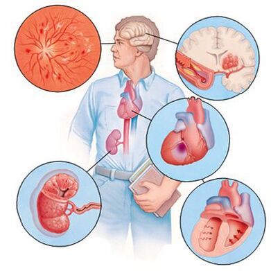 Cardiol zapobiega rozwojowi chorób współistniejących